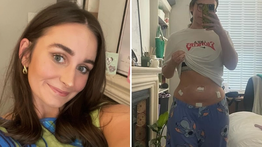 Woman who was left ‘in excruciating pain’ opens up on the massive 'relief' from finally getting diagnosis after 14 years