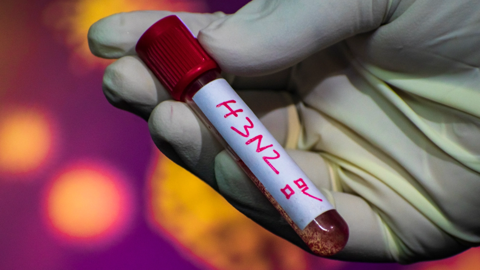 One major sign of ‘dangerous’ H3N2 flu that’s different from normal flu - as cases surge