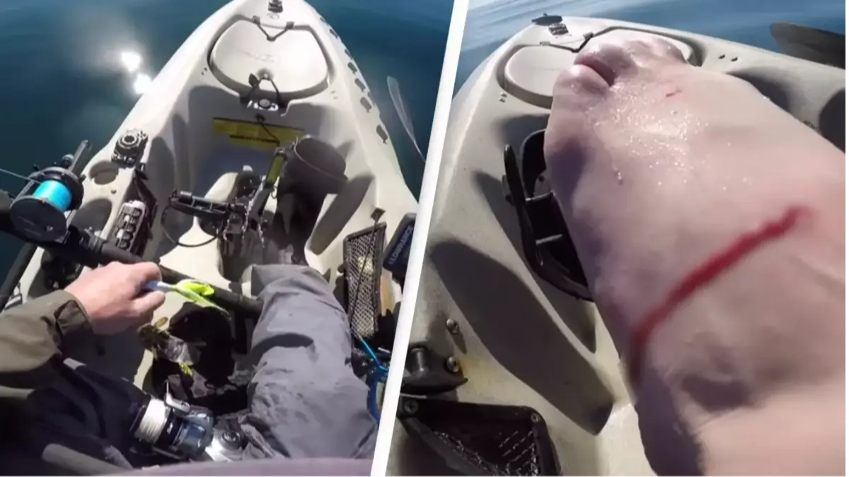 Mantis shrimp punches hole in fisherman's foot after being caught