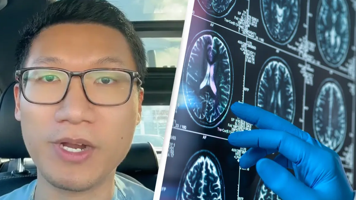 Doctor reveals easy 2-minute tests that could explain if you have early signs of dementia