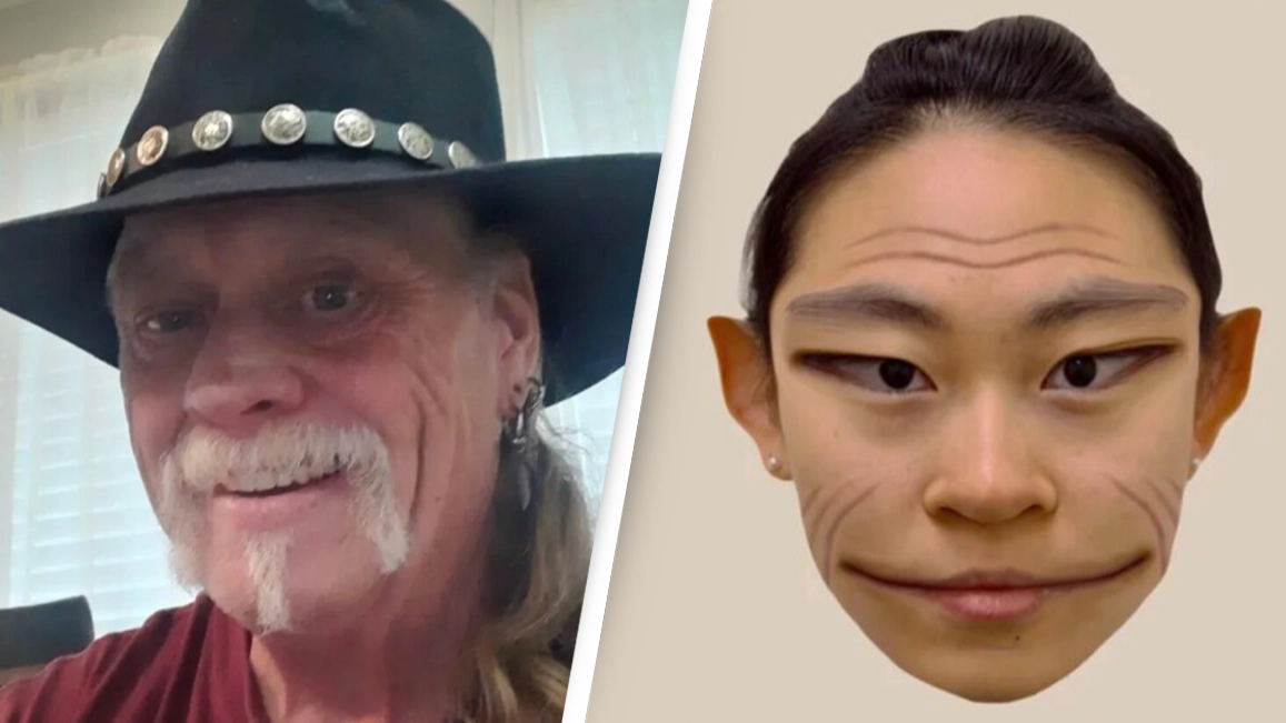 Man lives real-life nightmare with rare condition that makes people look like 'demons'