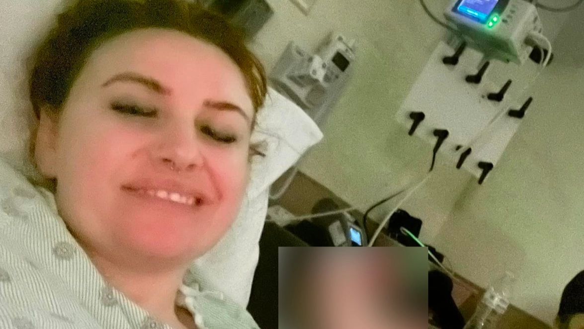 Bride's face left paralyzed on her wedding day after doctors assured symptoms were 'completely fine'