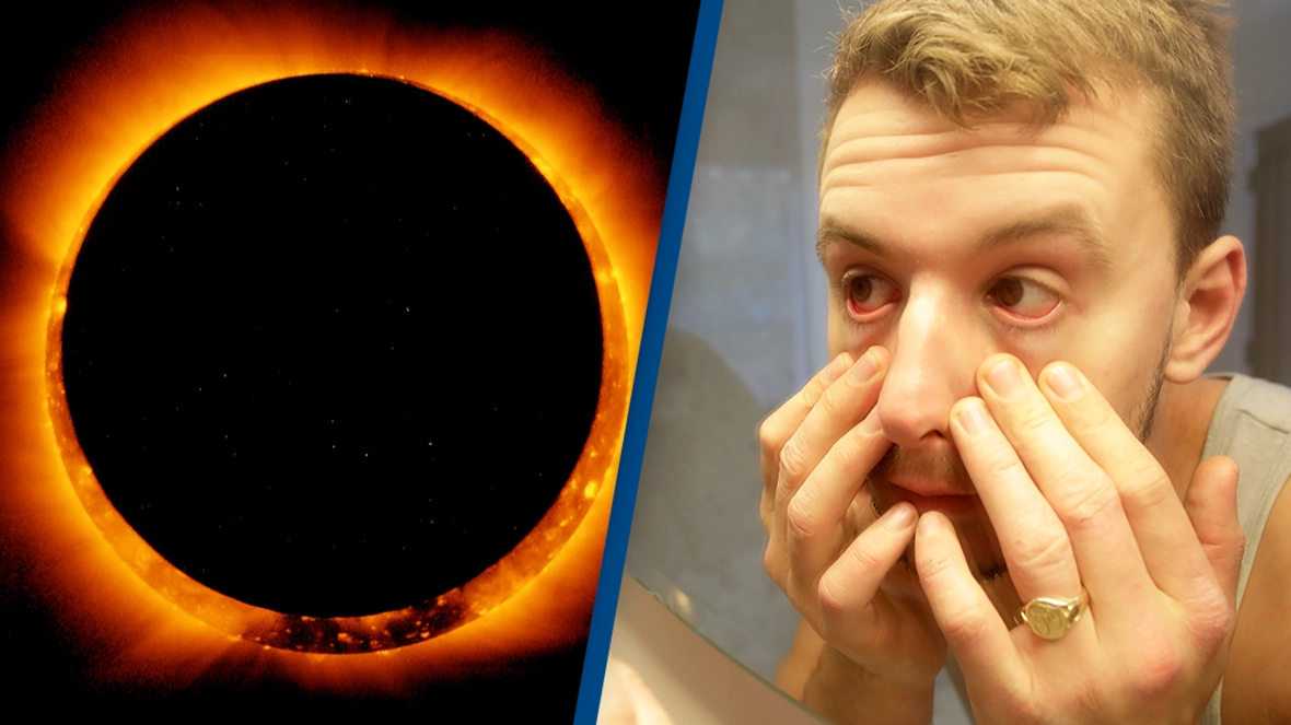 Google searches for 'why do my eyes hurt' skyrocket immediately after solar eclipse