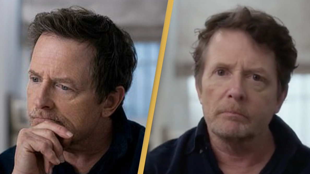 Michael J. Fox has broken several bones and almost lost a finger due to his Parkinson's disease