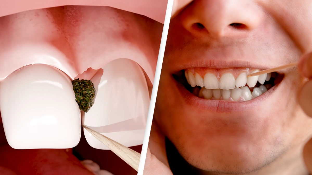 'Traumatizing' simulation shows why you should never use a toothpick to clean your teeth