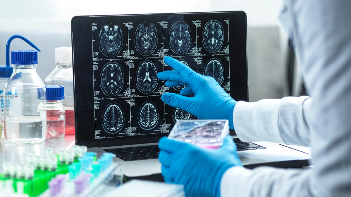 Scientists claim eating this specific thing once a week could help reduce your risk of Alzheimer's by 47%