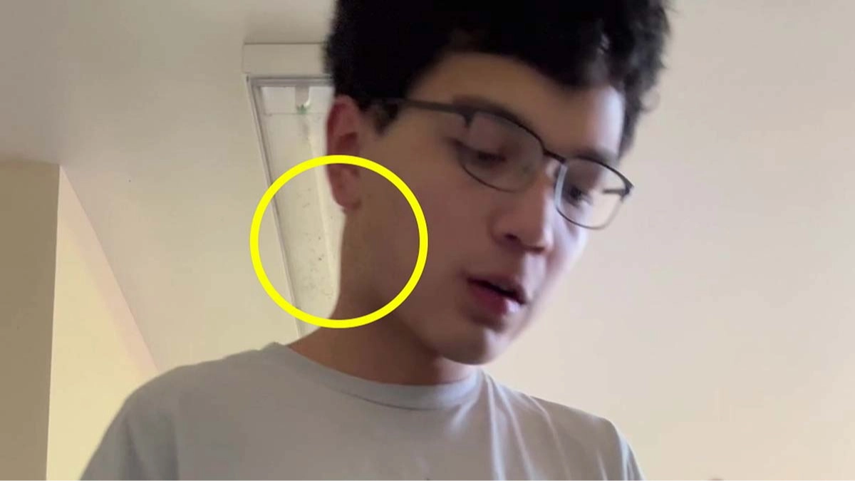 Student claims TikTok saved his life after noticing concerning symptom while taking part in online trend
