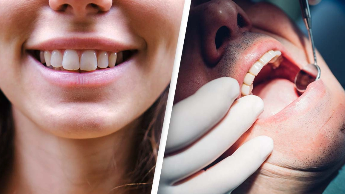 Scientists reveal the 'real reason' why people have crooked teeth and why that wasn't always the case