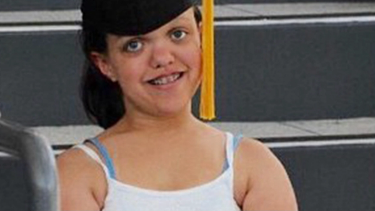 Woman who had controversial surgery to grow 13 inches as a teen reveals what she looks like now
