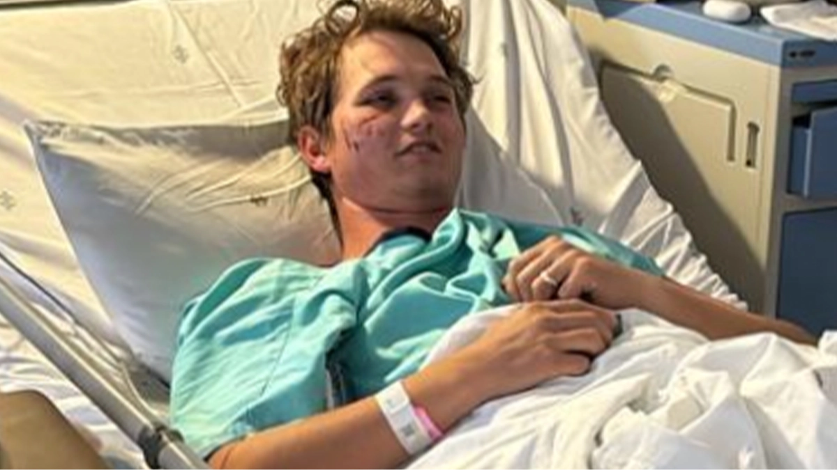 Man attacked by hyenas while sleeping at bachelor party survived because of these two actions