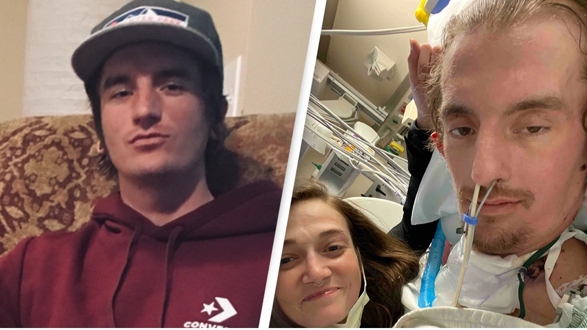 Doctors use breast implants to save man who needed double lung transplant after vaping