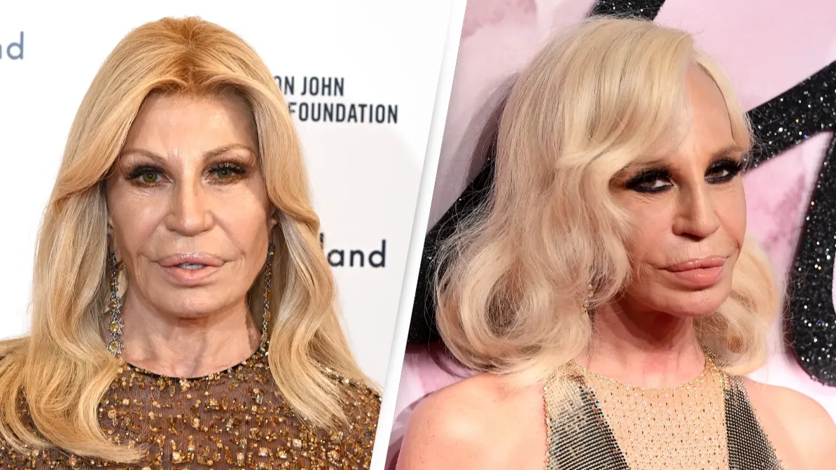 Experts explain what's caused Donatella Versace's dramatic transformation as fans express shock