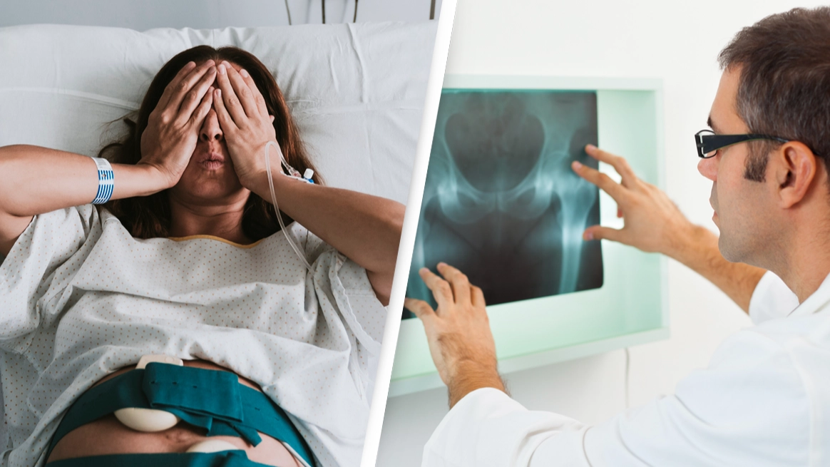 Woman shocked after discovering 'severe pain' was caused by needle left in vagina 18 years on from childbirth