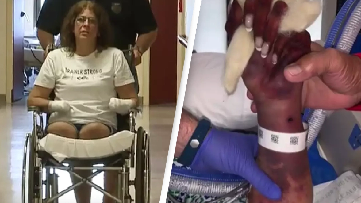 Mom lost all her limbs after doing 'normal' thing when she walked into her home