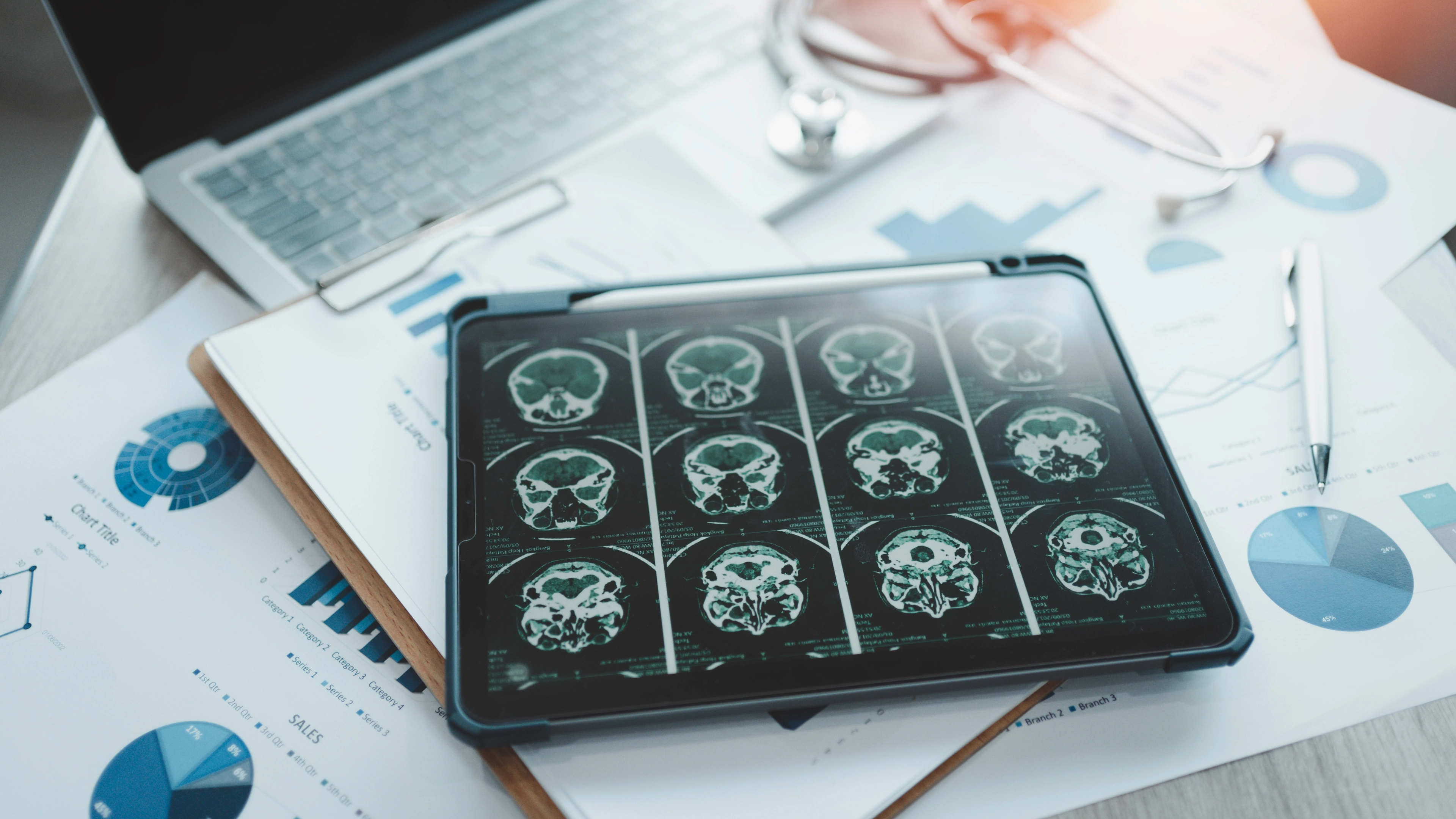 Scientists have discovered an early warning sign of Alzheimer's visible in routine scans