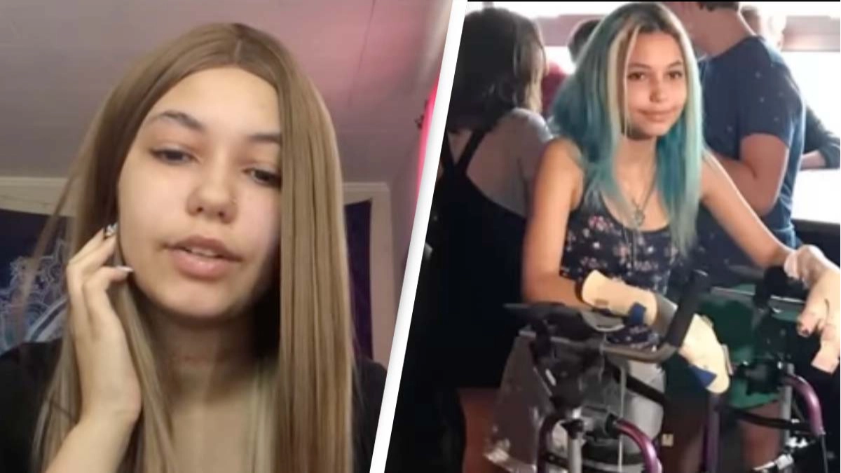 Woman Who Had Leg Ripped Off By Shark Explains How She Survived