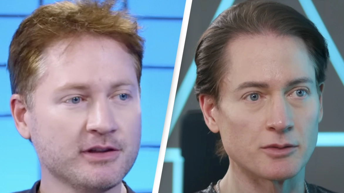 Biohacker who used son's blood to 'reverse aging' says he's 'transitioning'