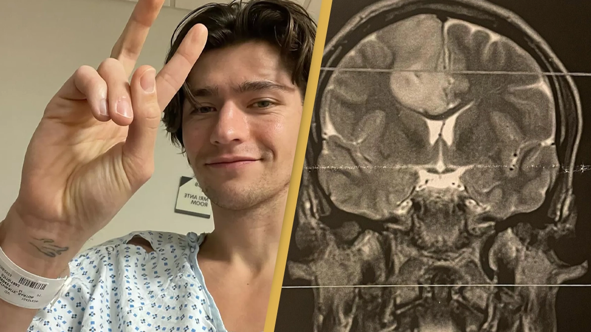 Netflix star Barton Cowperthwaite reveals stage two glioma diagnosis