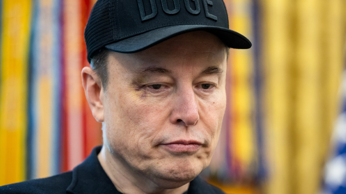 Elon Musk speaks out on black eye noticed by the public at White House farewell event