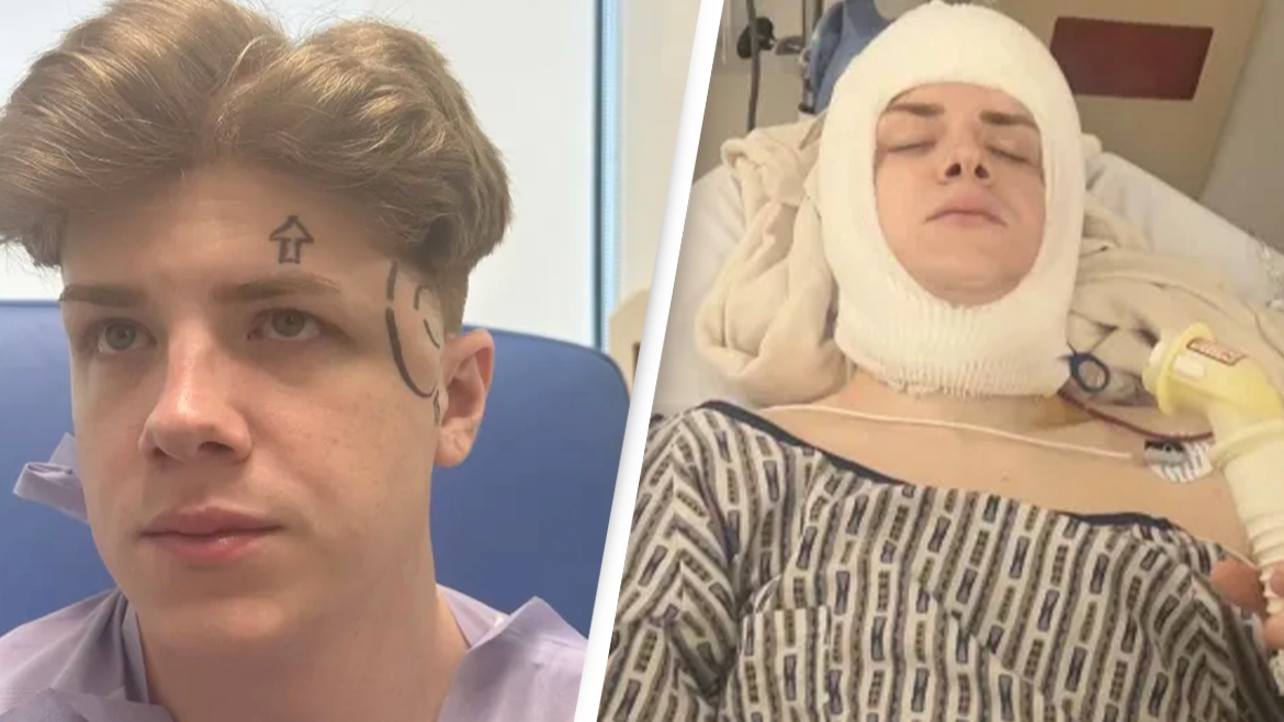 Man's skull has been removed four times because he has to have his brain washed