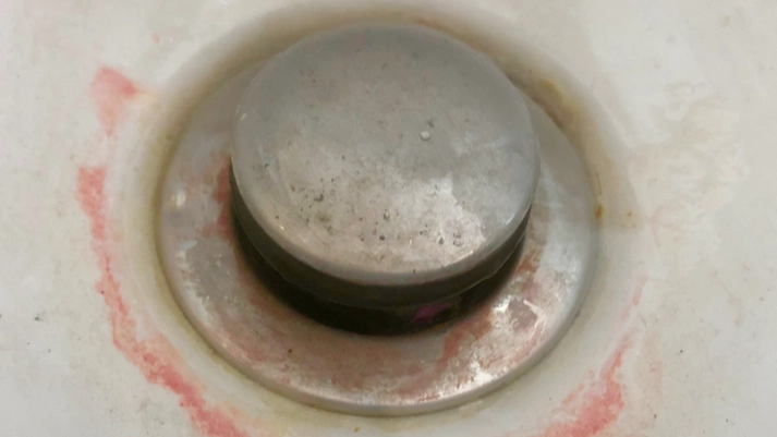 Doctor shares disturbing warning to anyone who finds 'pink slime' in their bathroom