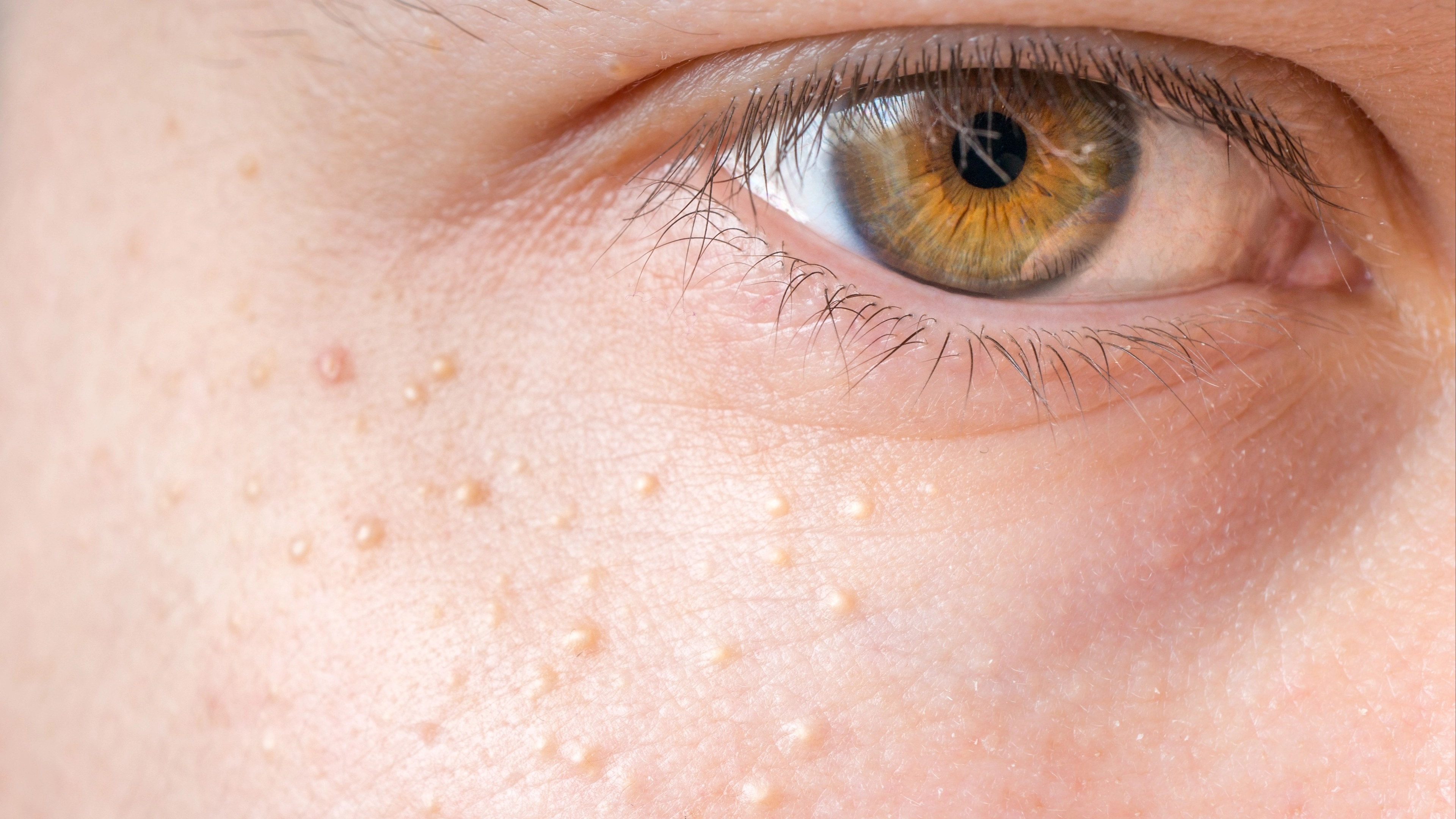 Experts issue serious warning to people with series of white spots on their body and private parts