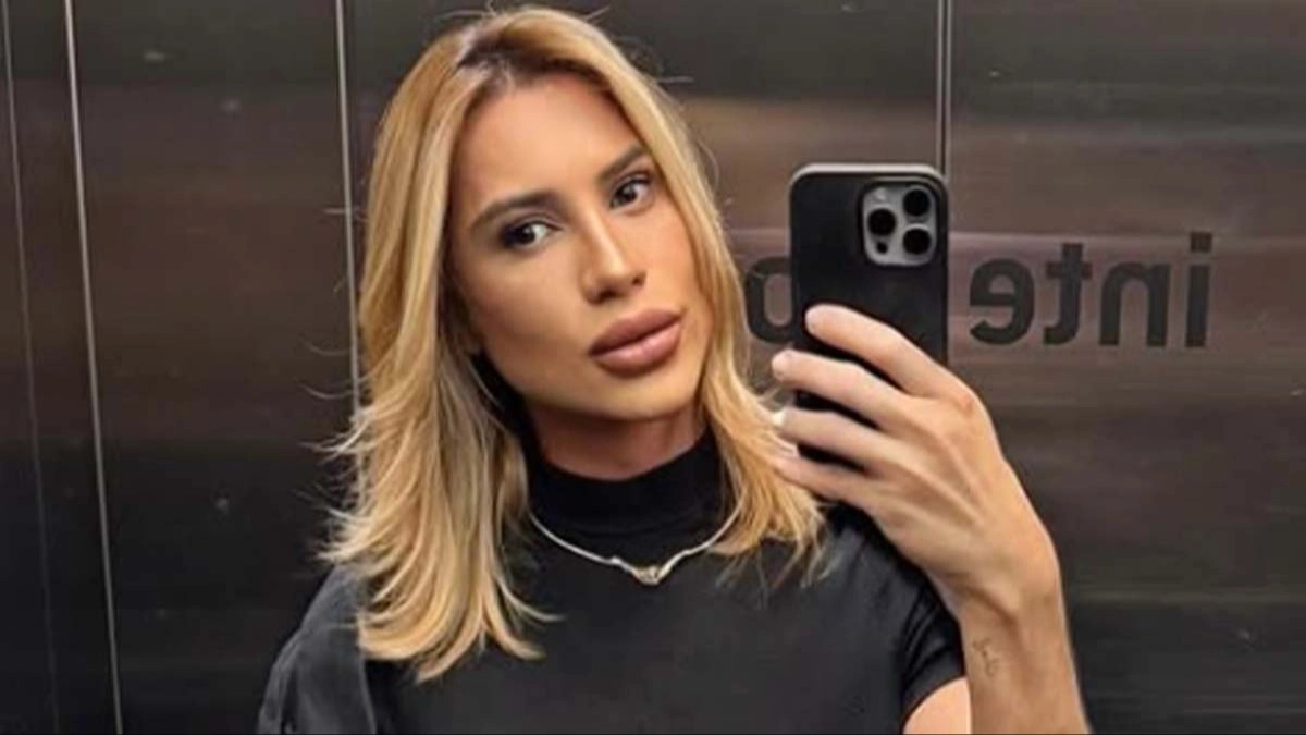 Influencer dies after complaining about complications from popular 'Fox Eyes' surgery