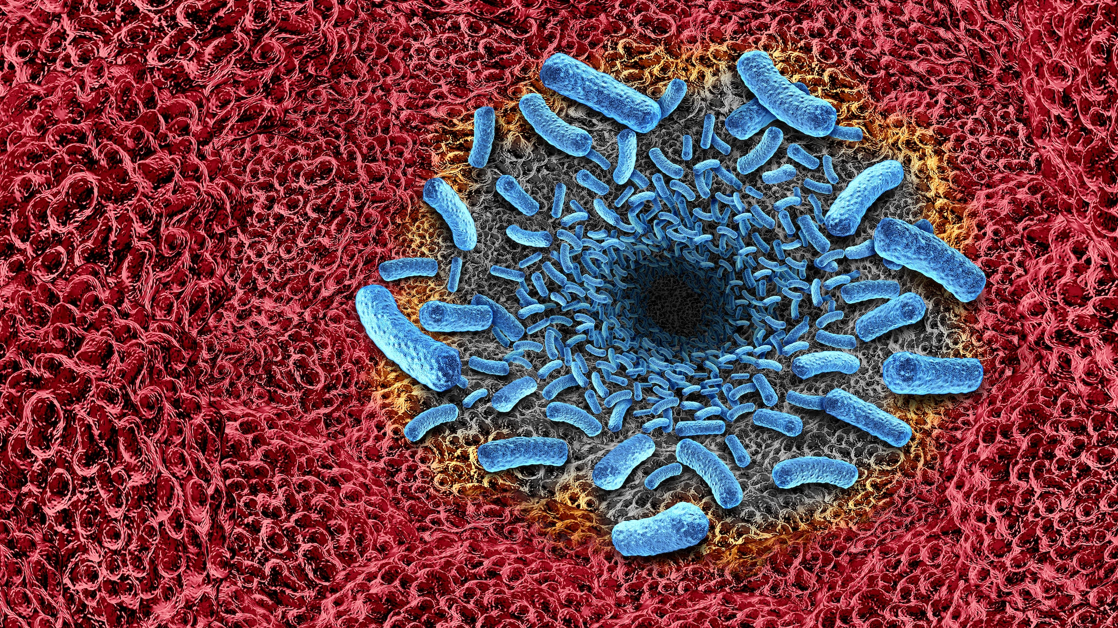 Flesh-eating bacteria in Long Island waters causes 20% risk of dying in 48 hours