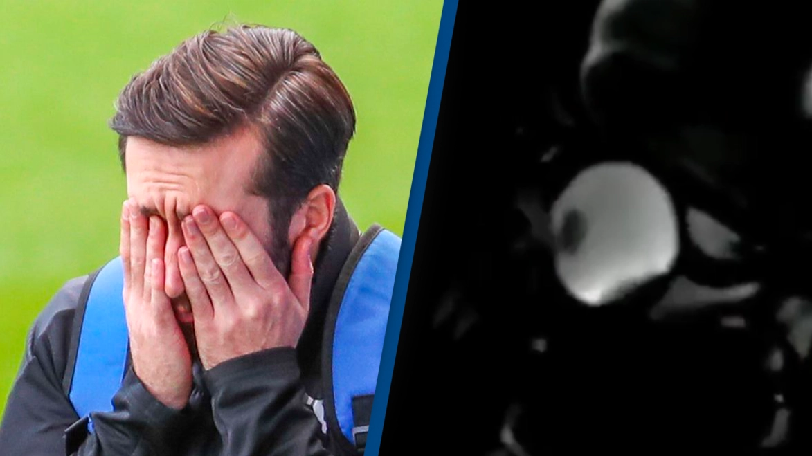 MRI scan shows what rubbing your eyes looks like and people are very satisfied
