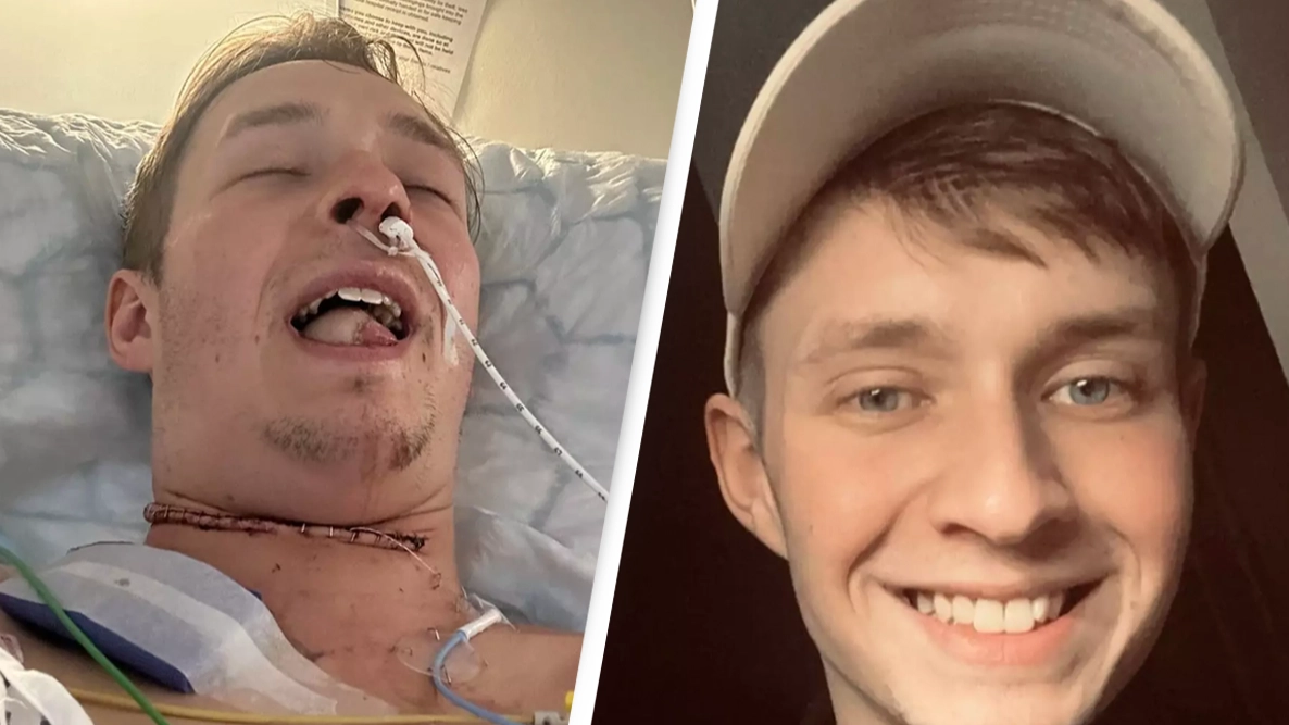 Man has tongue removed after ignoring common warning sign of cancer