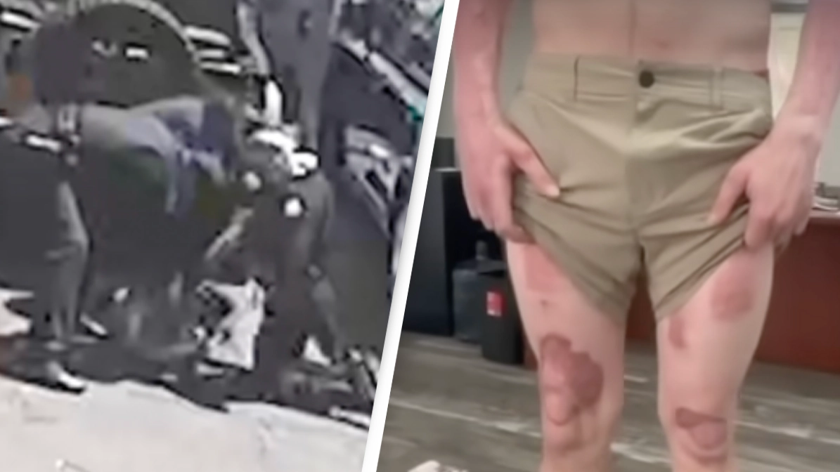 Man left with third-degree burns after police pinned him to the ground in record heat