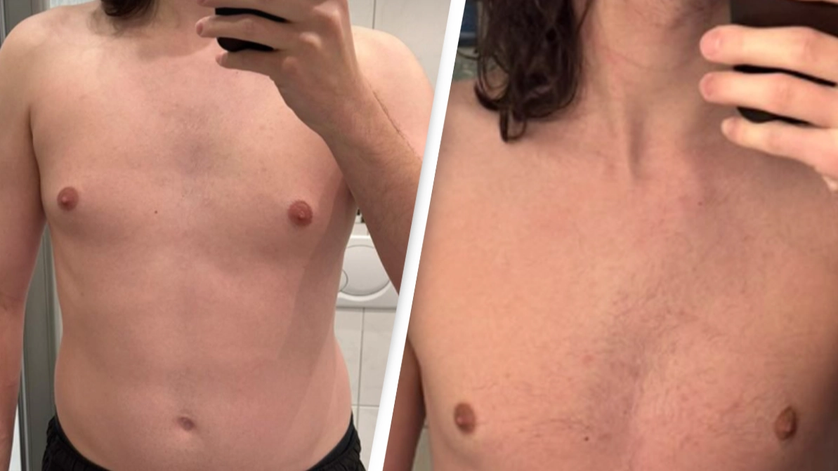 Man who had no food and only water for 30 days reveals the impact it had on his body