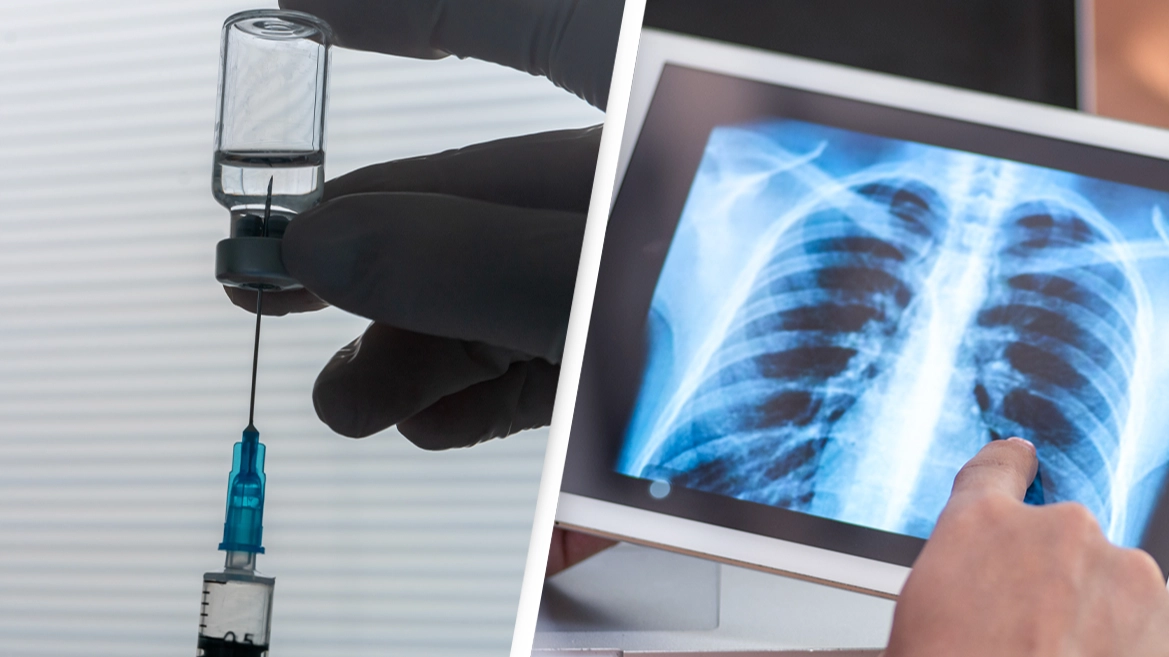 World’s first lung cancer vaccine being developed
