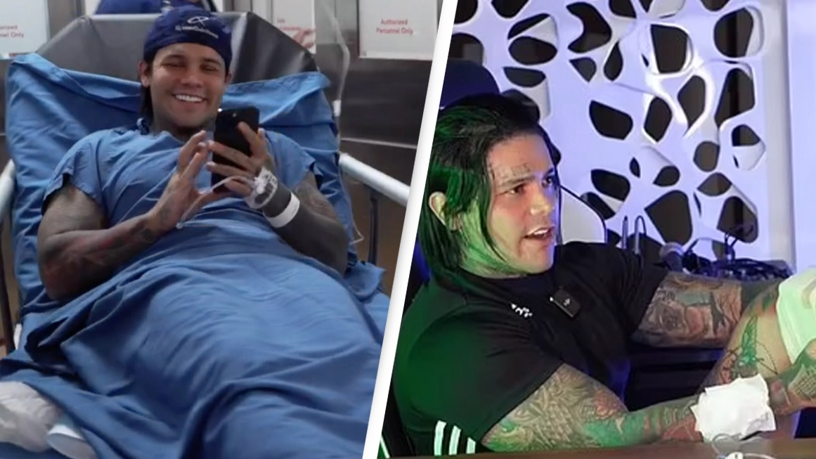 Influencer left in constant pain after leg lengthening surgery to grow to 6ft