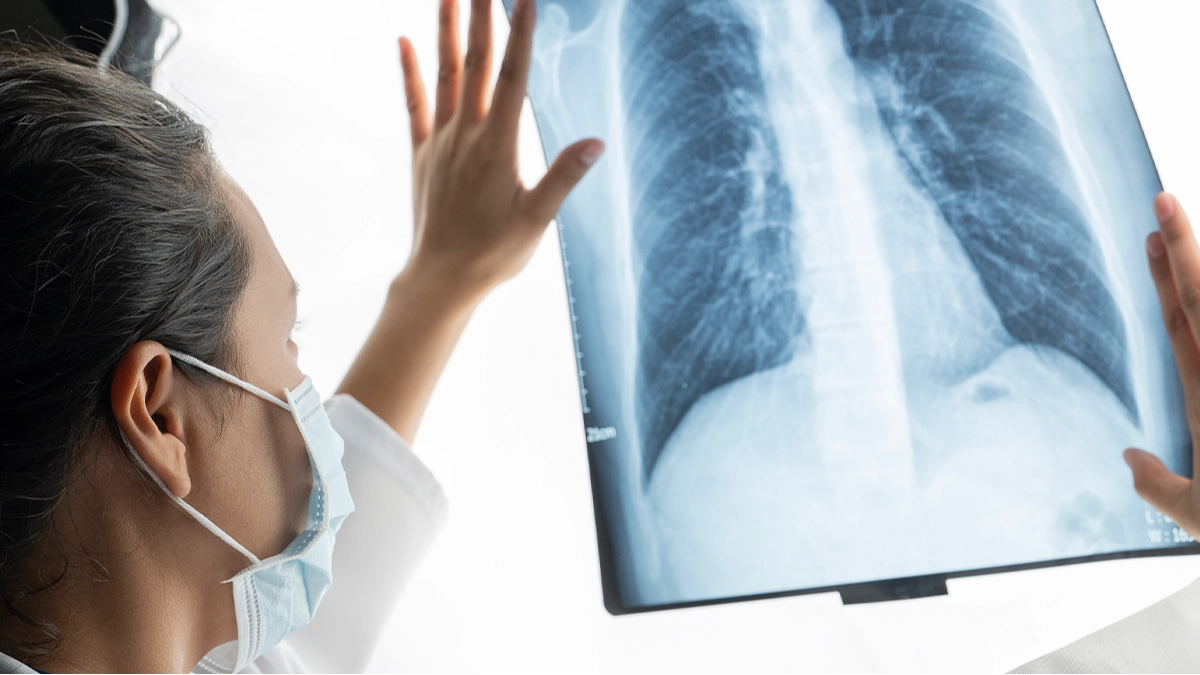 Reason people who have never smoked are possibly being diagnosed with lung cancer
