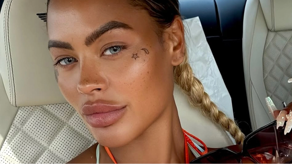 Why influencer isn't put off plastic surgery despite spending over $85,000 to correct bum implants that 'fell out' in the gym