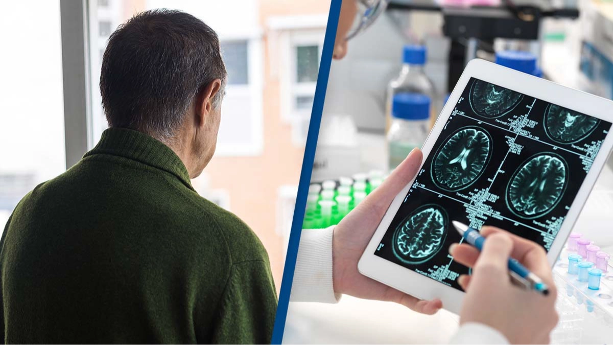 Scientists discover Alzheimer’s can spread from human to human through rare medical accidents