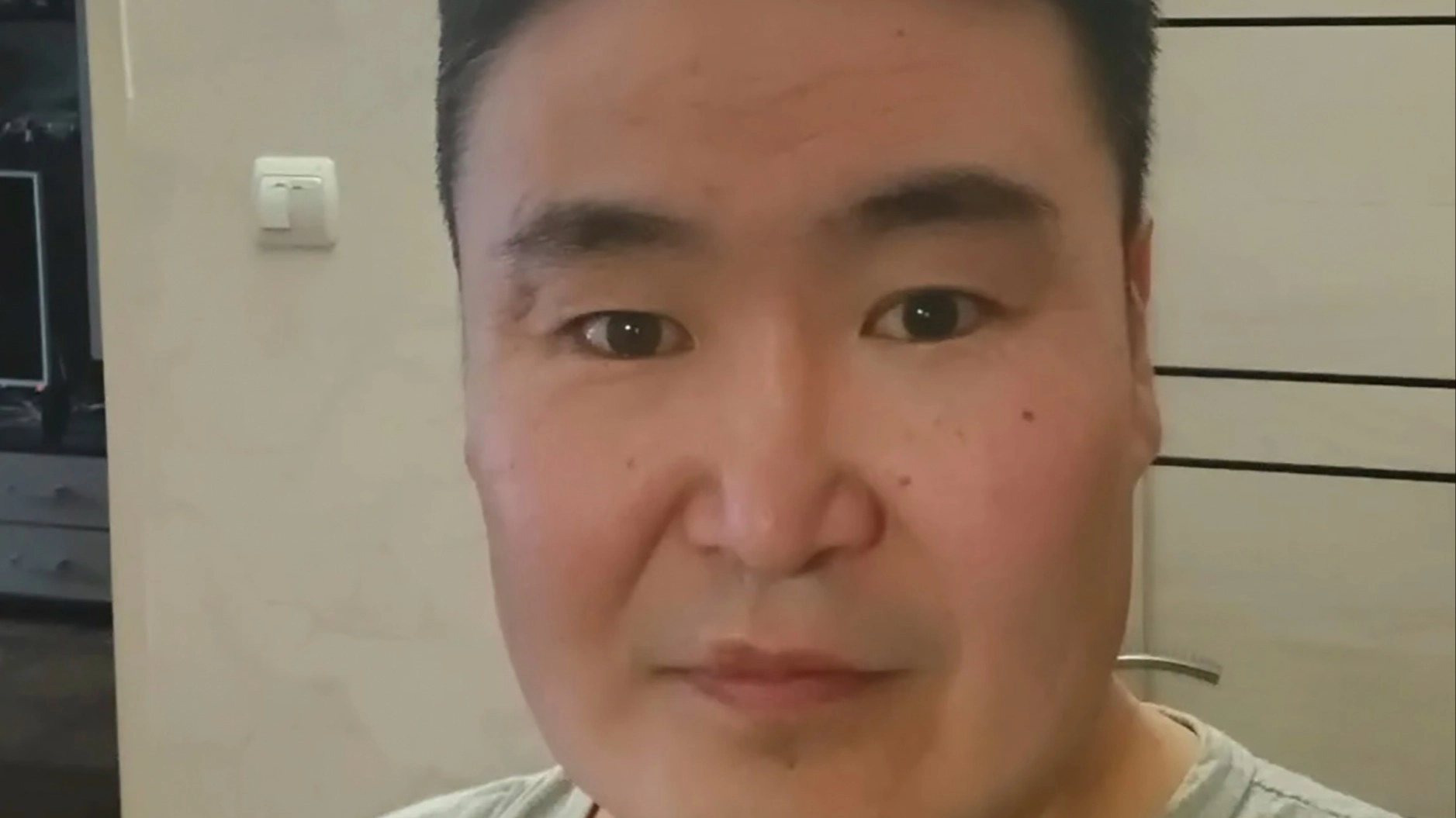 Man discovered plant was growing in his eye after four months of agonizing headaches