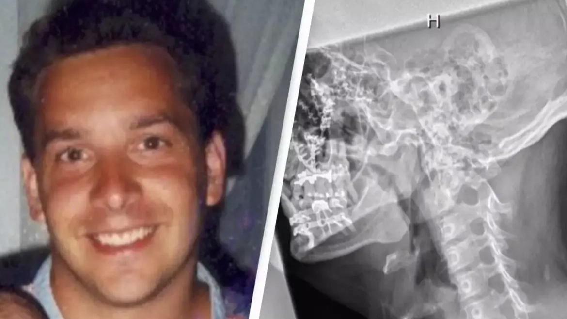 Man whose head was crushed by 10,000lbs of stone saw dead friend while he ‘died’ for five minutes