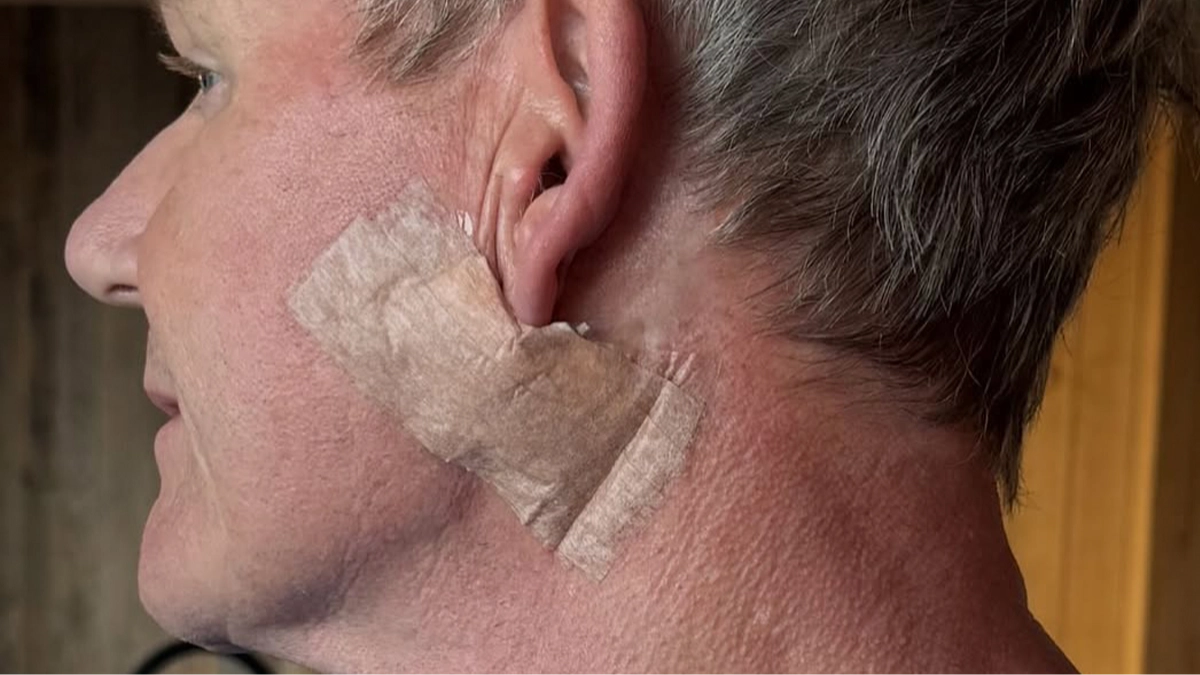 Signs to look out for amid Gordon Ramsay's health warning after undergoing cancer surgery