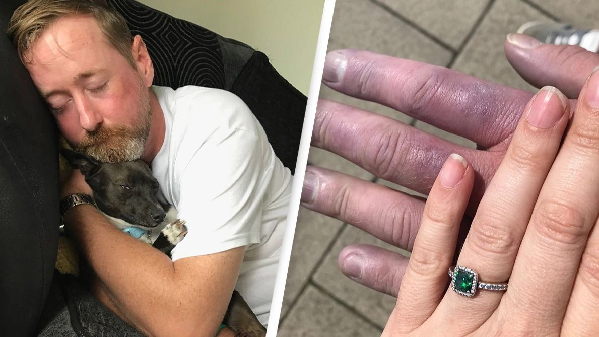 Man who thought his hands were ‘cold’ issues warning after being diagnosed with life-threatening condition