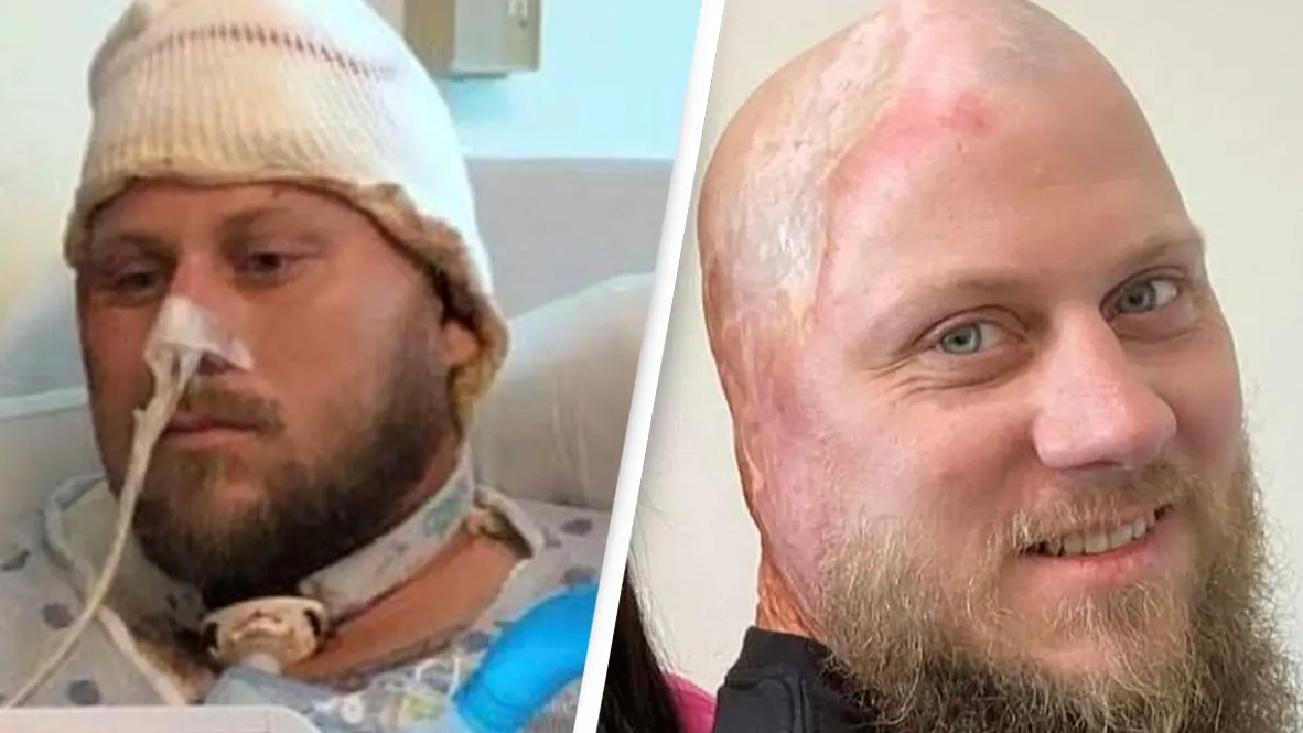 Man who was electrocuted by 4,160 volts horrifically watched his 'skin melt'