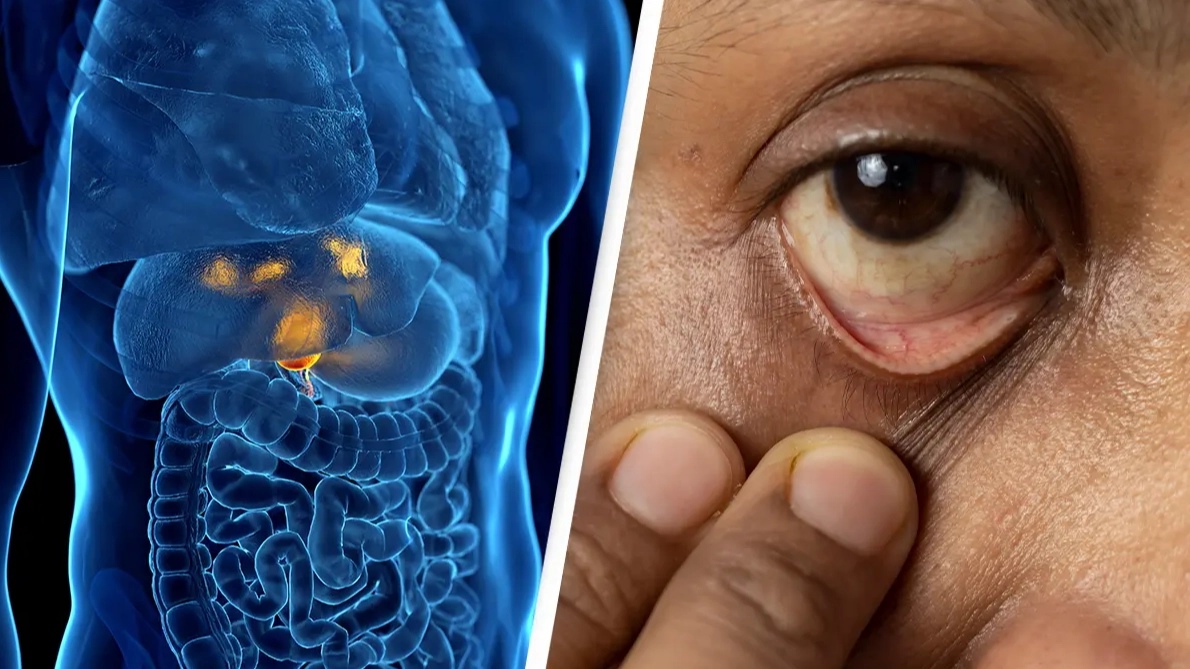 Little-known form of cancer surges in young people and there's one alarming reason why