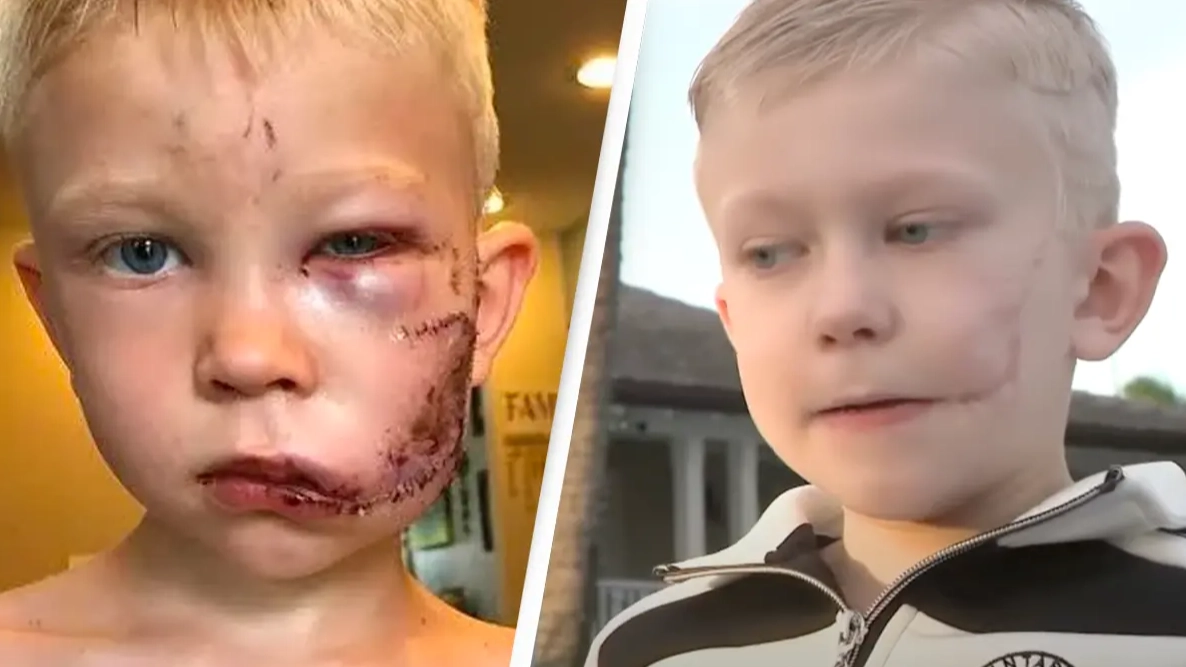 Boy hailed hero after risking his life to save sister from brutal dog attack