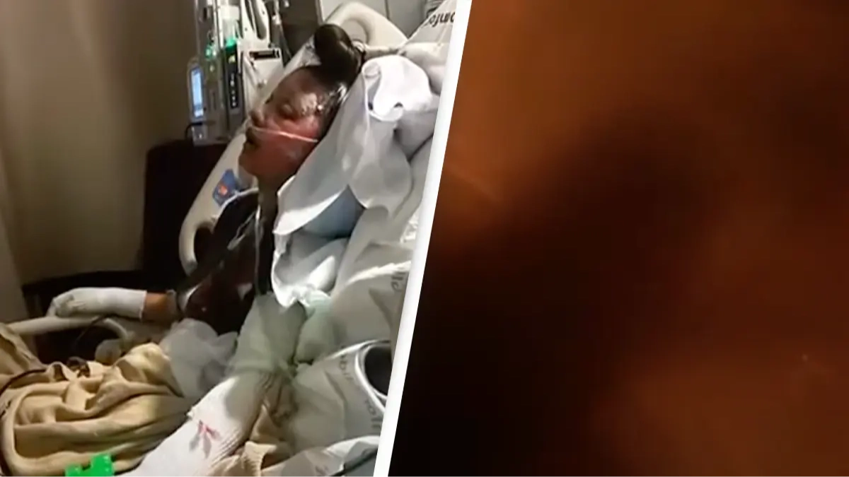 Group of teenagers left disfigured after boy throws 55-gallon fuel drum on beach bonfire