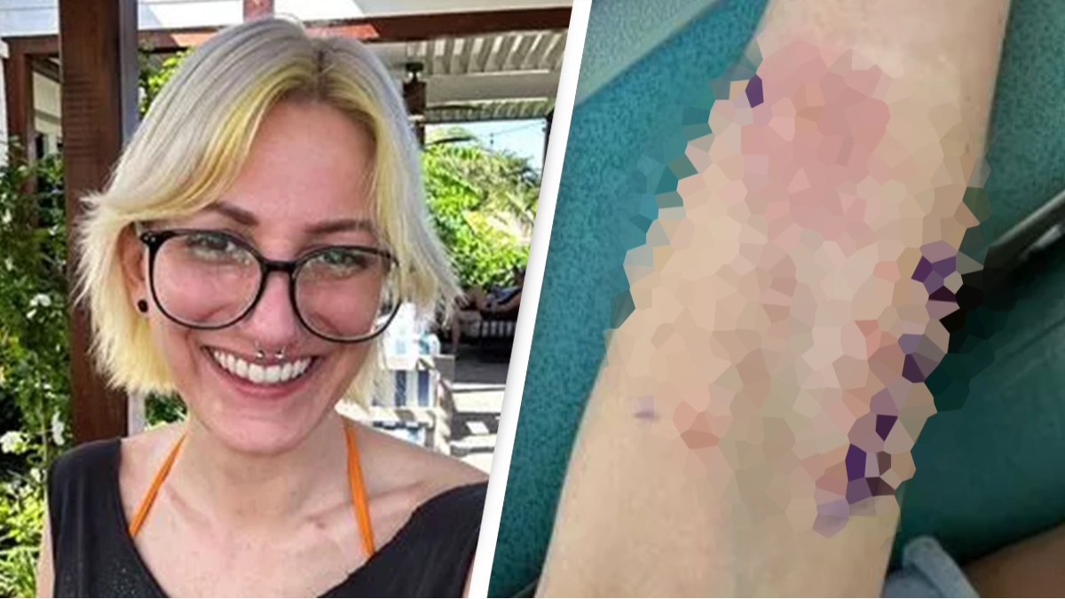 Woman 'terrified' of sex with boyfriend after his semen gives her 'extremely painful' burns