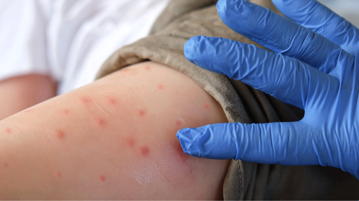 Virus that saw China take ‘covid measures’ after reporting 7,000 cases is suspected to be in the US