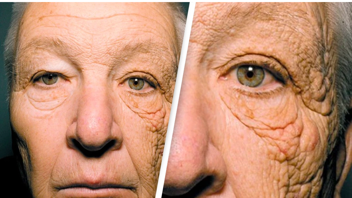 Shocking photo of driver who didn’t wear suncream shows what 28 years of sun damage looks like