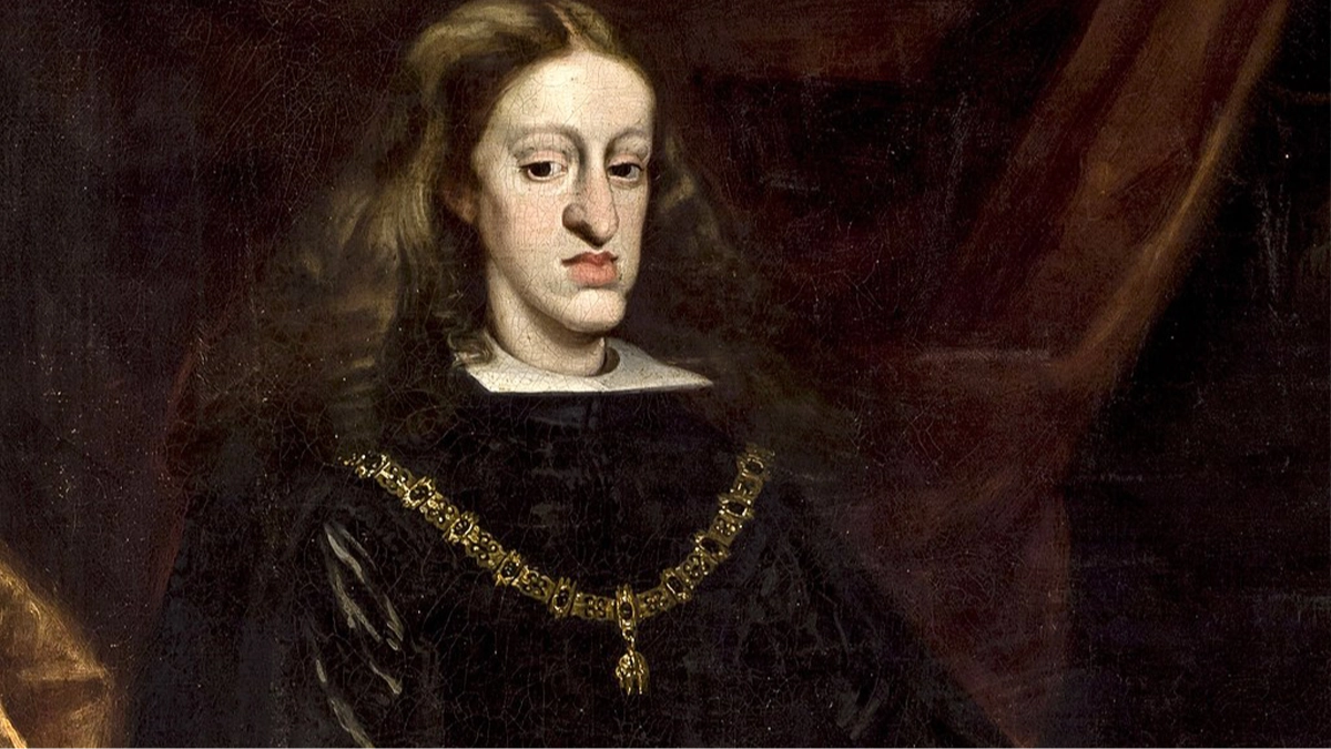 3 of the most inbred people in history suffered from these shocking conditions