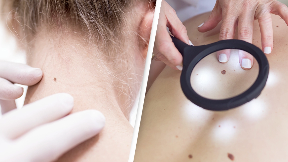 Study reveals millennials face higher risk of 17 cancers than older generations